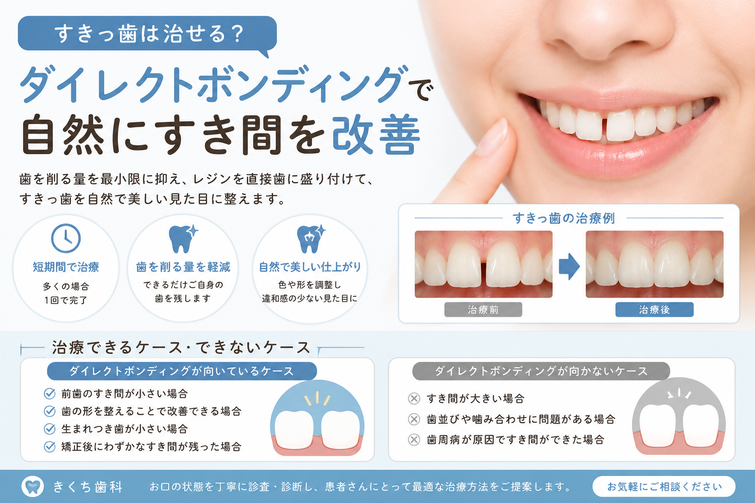 すき っ 歯 自力 で 治す 方法